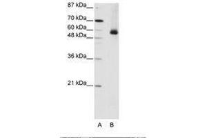 Image no. 2 for anti-Heterogeneous Nuclear Ribonucleoprotein L (HNRNPL) (AA 281-330) antibody (ABIN203218) (HNRNPL antibody  (AA 281-330))