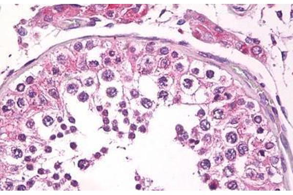 Bax Inhibitor 1 antibody