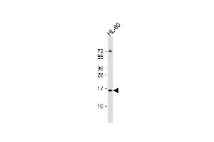 Anti-KISS1 Antibody (C-Term)at 1:2000 dilution + HL-60 whole cell lysates Lysates/proteins at 20 μg per lane. (KISS1 antibody  (AA 115-145))