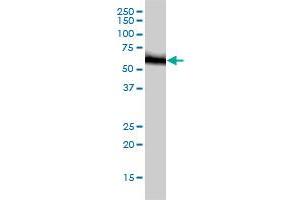 RNMT monoclonal antibody (M01), clone 3H3-1D12 Western Blot analysis of RNMT expression in HeLa . (RNMT antibody  (AA 1-476))