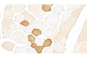 Detection of TNNT1 in Human Skeletal muscle Tissue using Polyclonal Antibody to Troponin T Type 1, Slow Skeletal (TNNT1) (TNNT1 antibody  (AA 1-259))