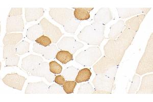 Detection of TNNT1 in Human Skeletal muscle Tissue using Polyclonal Antibody to Troponin T Type 1, Slow Skeletal (TNNT1)