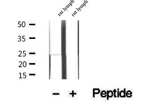 Western blot analysis of extracts of rat lymph tissue, using LAPTM4B antibody.