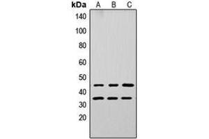Western blot analysis of Apolipoprotein L3 expression in A549 (A), PC12 (B), NS-1 (C) whole cell lysates. (APOL3 antibody  (Center))