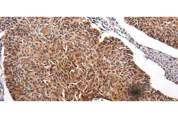 RAB41 antibody