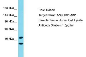Host: Rabbit Target Name: ANKRD20A8P Sample Type: Jurkat Whole Cell lysates Antibody Dilution: 1. (ANKRD20A8P antibody  (C-Term))