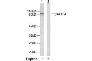Image no. 2 for anti-Signal Transducer and Activator of Transcription 5A (STAT5A) (Tyr694) antibody (ABIN197181) (STAT5A antibody  (Tyr694))