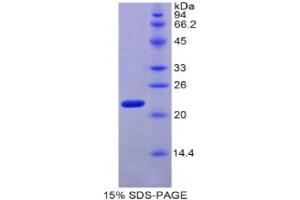SDS-PAGE analysis of Mouse MYL4 Protein. (MYL4 Protein)