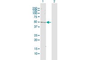 Western Blot analysis of ZWILCH expression in transfected 293T cell line by ZWILCH MaxPab polyclonal antibody. (ZWILCH antibody  (AA 1-477))