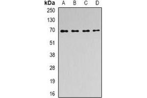 Western blot analysis of ACAD9 expression in MCF7 (A), SKOV3 (B), mouse kidney (C), rat brain (D) whole cell lysates. (ACAD9 antibody)
