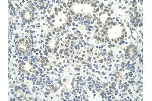 Rabbit Anti-ZNF280D antibody         Paraffin Embedded Tissue:  Human Lung    cell Cellular Data:  alveolar cell    Antibody Concentration:  4. (ZNF280D antibody  (N-Term))