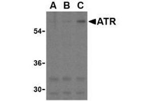 Image no. 1 for anti-anthrax Toxin Receptor 1 (ANTXR1) (C-Term) antibody (ABIN205805) (ANTXR1 antibody  (C-Term))