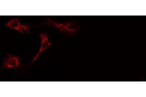 ABIN6269155 staining Hela cells by IF/ICC. (VAV1 antibody  (N-Term))