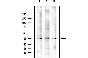 anti-Annexin A2 (ANXA2) (Internal Region) antibody