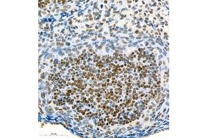 Immunohistochemistry of paraffin embedded mouse ovary using Skar (ABIN7074970) at dilution of 1:900 (400x lens) (p46 antibody)