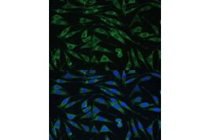 Immunofluorescence analysis of L929 cells using Dynamin 3 Polyclonal Antibody  at dilution of 1:100 (40x lens). (Dynamin 3 antibody  (AA 410-555))