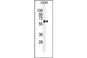 Western blot analysis of DOK3 Antibody (C-term) in CEM cell line lysates (35ug/lane).