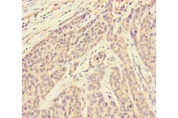 RBM17 antibody  (AA 1-240)