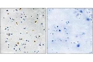 Immunohistochemistry analysis of paraffin-embedded human brain tissue, using DIL-2 Antibody. (TPX2 antibody  (AA 301-350))