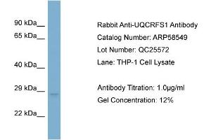 WB Suggested Anti-UQCRFS1  Antibody Titration: 0. (UQCRFS1 antibody  (N-Term))