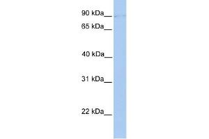 POMT2 antibody used at 1 ug/ml to detect target protein. (POMT2 antibody  (Middle Region))