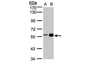 WB Image Sample(30 ug whole cell lysate) A:H1299 B:MOLT4 , 7. (RCC2 antibody)