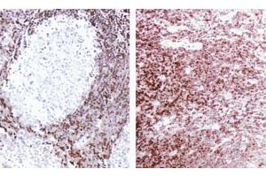 Formalin-fixed, paraffin-embedded tissue sections stained for Bcl-2 expression using clone Bcl-2/100 and the SA-HRP method. (Bcl-2 antibody  (AA 41-54))