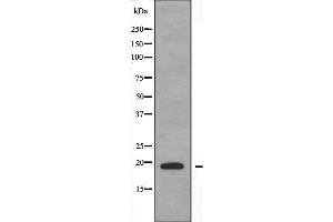 Western blot analysis of extracts from COLO205 cells, using TNFSF15 antibody. (TNFSF15 antibody  (C-Term))