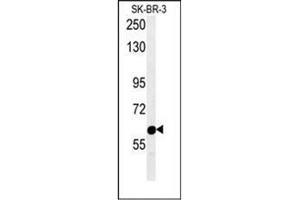 Western blot analysis of RADIL Antibody (C-term) in SK-BR-3 cell line lysates (15ug/lane). (Radil antibody  (C-Term))