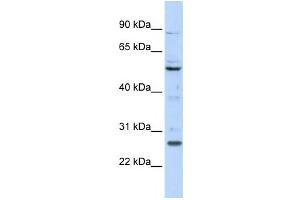Western Blotting (WB) image for anti-Homeobox C5 (HOXC5) antibody (ABIN2458390) (Homeobox C5 antibody)