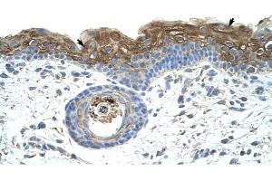 EIF2A antibody was used for immunohistochemistry at a concentration of 4-8 ug/ml to stain Epidermal cells (arrows) in Human Skin. (EIF2A antibody  (C-Term))