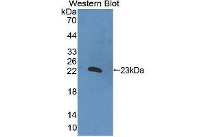 Western Blotting (WB) image for anti-Interleukin 2 (IL2) (AA 1-142) antibody (ABIN1172179) (IL-2 antibody  (AA 1-142))