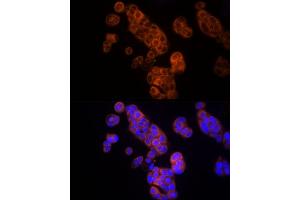 Immunofluorescence analysis of MCF7 cells using Thymidine Kinase 1 Rabbit pAb (ABIN6132726, ABIN6149198, ABIN6149199 and ABIN6221245) at dilution of 1:150 (40x lens). (TK1 antibody  (AA 1-234))