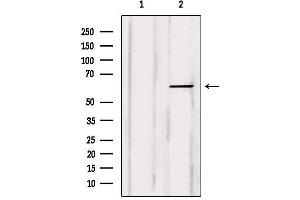 Western blot analysis of extracts from Myeloma cells, using COT Antibody. (MAP3K8 antibody  (Internal Region))