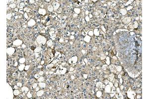 IHC analysis of Serum Amyloid P/APCS using anti-Serum Amyloid P/APCS antibody (ABIN5693182). (APCS antibody  (AA 20-220))