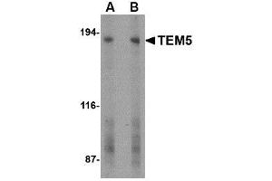 Image no. 1 for anti-G Protein-Coupled Receptor 124 (GPR124) (C-Term) antibody (ABIN1493352) (GPR124 antibody  (C-Term))