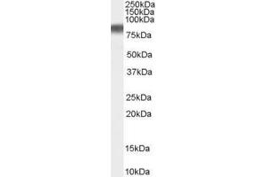 ABIN184775 staining (0. (JUP antibody  (C-Term))