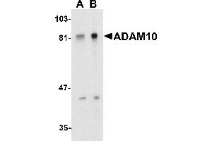 Western Blotting (WB) image for anti-ADAM Metallopeptidase Domain 10 (ADAM10) (C-Term) antibody (ABIN1030219) (ADAM10 antibody  (C-Term))