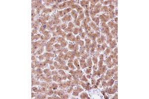 Immunohistochemical analysis of B on paraffin-embedded Human liver tissue. (PEMT antibody  (C-Term))