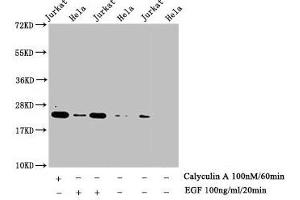 Western Blot Detected samples: Jurkat whole cell lysate, Hela whole cell lysate, Untreated (-) or treated (+) with Calyculin A and EGF All lanes: HIST1H1E antibody at 1:1000 Secondary Goat polyclonal to rabbit IgG at 1/40000 dilution Predicted band size: 22 kDa Observed band size: 22 kDa (HIST1H1E antibody  (pThr17))