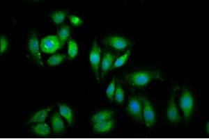 Immunofluorescence staining of A549 cells with ABIN7152126 at 1:100, counter-stained with DAPI. (EIF1 antibody  (AA 2-113))