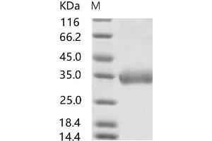 MERS-Coronavirus Spike Protein (MERS-CoV S) protein (His tag,Biotin)