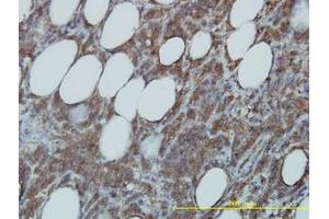Image no. 1 for anti-Cell Division Cycle 37 Homolog (S. Cerevisiae) (CDC37) (AA 1-379) antibody (ABIN599169) (CDC37 antibody  (AA 1-379))
