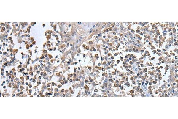 Ubinuclein 1 antibody