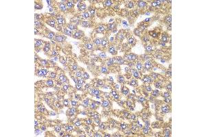 Immunohistochemistry of paraffin-embedded rat liver using UGDH antibody at dilution of 1:100 (400x lens). (UGDH antibody)