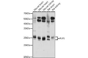 Western blot analysis of extracts of various cell lines, using PLP1 antibody (ABIN7269724) at 1:1000 dilution. (PLP1 antibody  (AA 145-210))