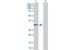 Western Blot analysis of DHRS3 expression in transfected 293T cell line by DHRS3 MaxPab polyclonal antibody. (DHRS3 antibody  (AA 1-302))