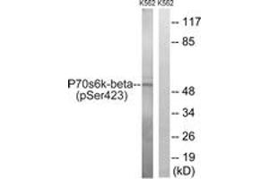 Western blot analysis of extracts from K562 cells treated with EGF 200ng/ml 5', using p70 S6 Kinase beta (Phospho-Ser423) Antibody. (RPS6KB2 antibody  (pSer423))