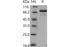 Western Blotting (WB) image for Calcium/calmodulin-Dependent Protein Kinase II alpha (CAMK2A) (Active) protein (GST tag) (ABIN7317100) (CAMK2A Protein (GST tag))
