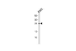 Western blot analysis of lysate from K562 cell line, using RAB27A Antibody at 1:1000. (RAB27A antibody  (C-Term))
